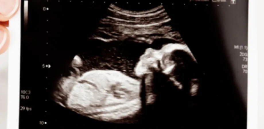 Állítsák meg a radikális abortusztörvény bevezetését Észak-Írországban!